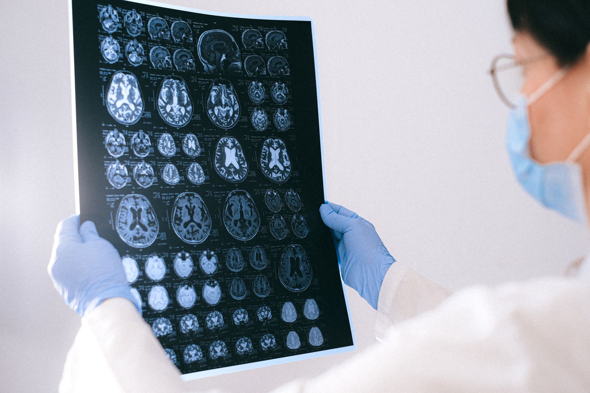 Alzheimer’s treatment benefits